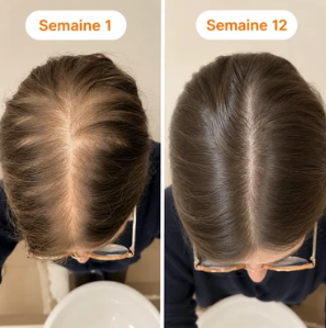 Comparaison avant et après utilisation