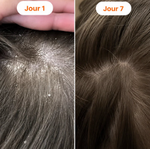 Comparaison avant et après utilisation
