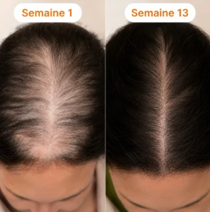 Comparaison avant et après utilisation