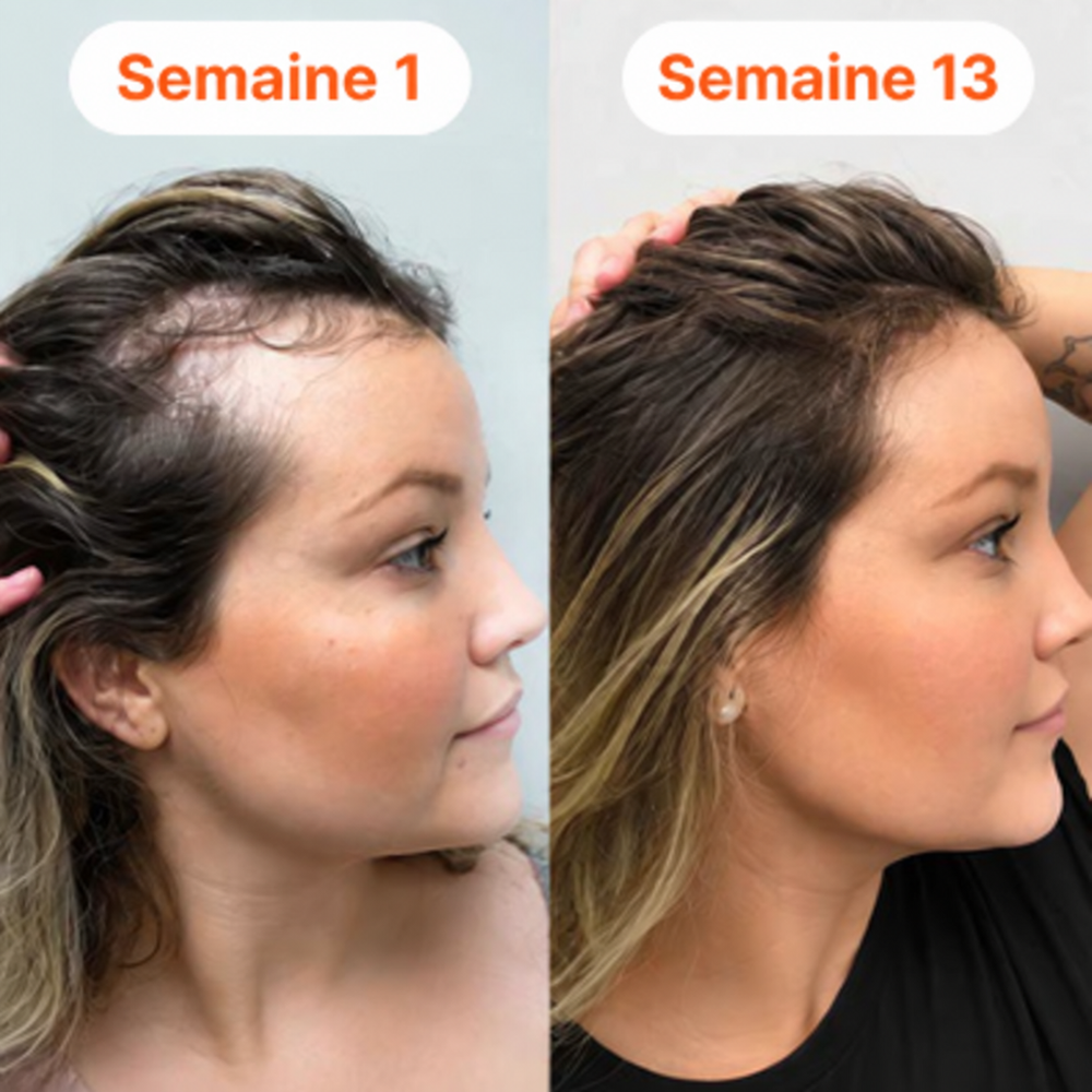 Comparaison avant et après utilisation
